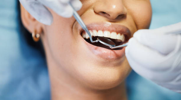 Best Emergency Root Canal Treatment in Swepsonville, NC