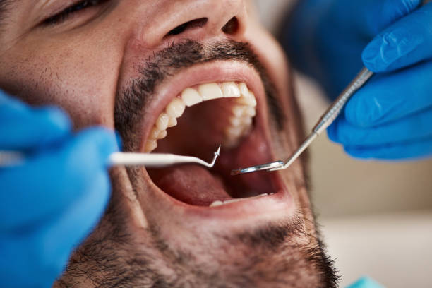 Best Holiday Emergency Dentist in Swepsonville, NC